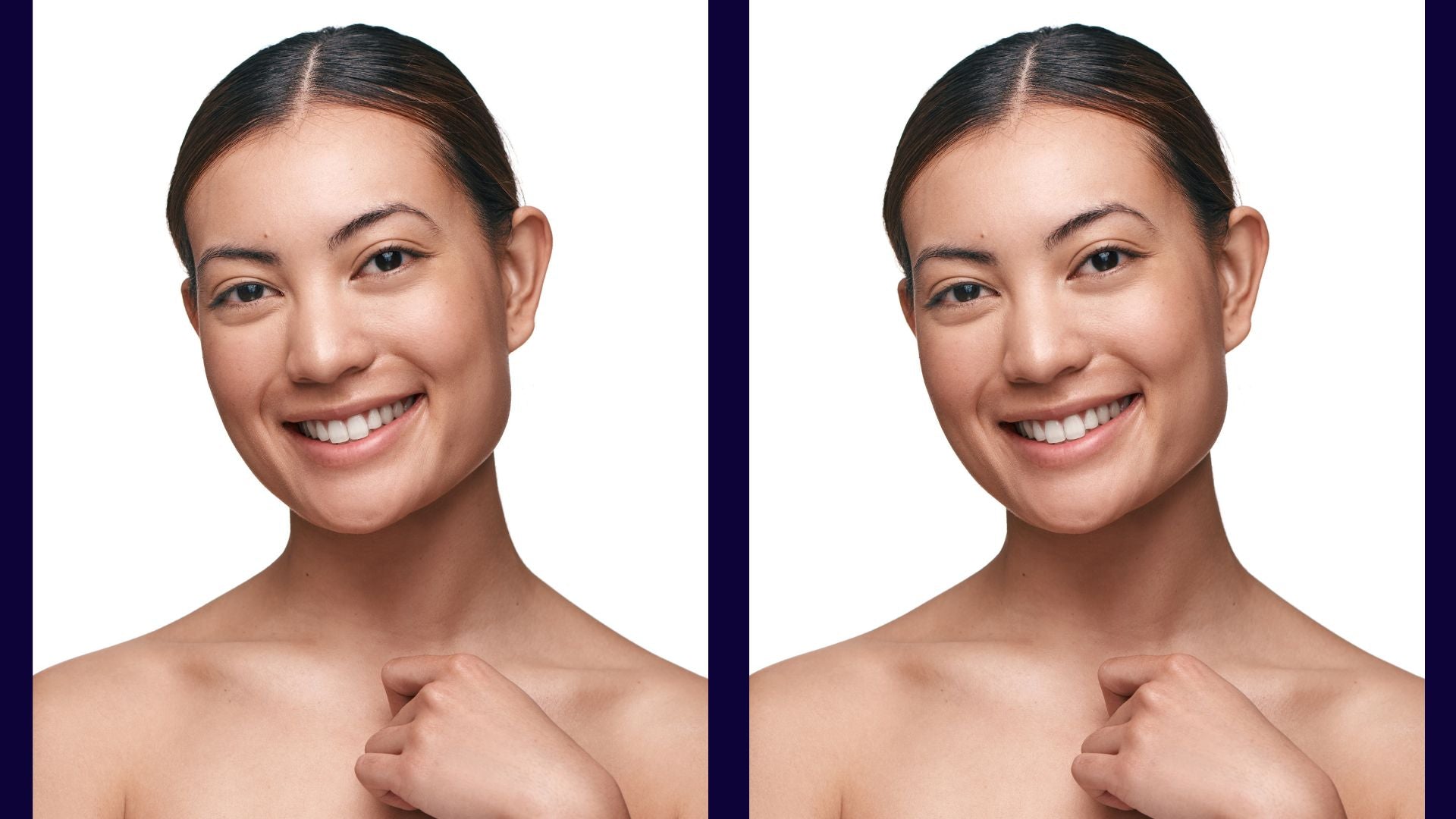 How To Cover Acne Scars With Make Up